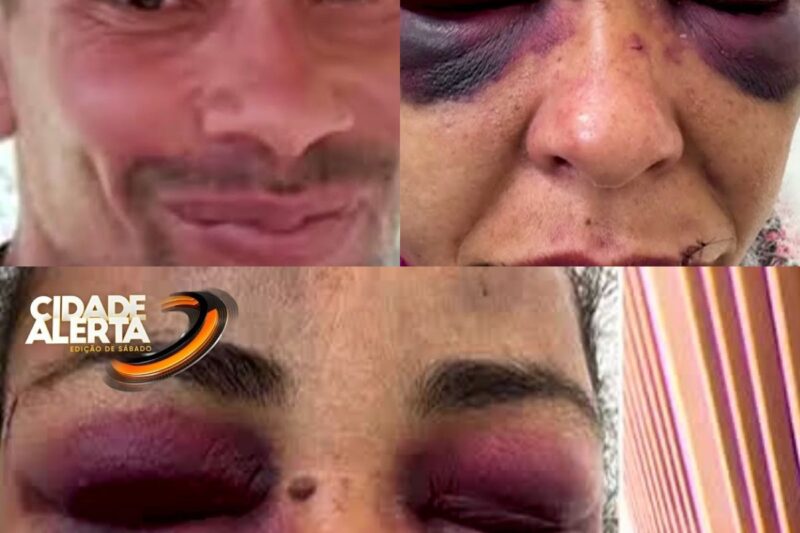 Rosto Destruído e o Filho de 7 Anos Como Escudo: O Plano Macabro do Ex-Marido Que Desafiou a Justiça e Chocou Mogi das Cruzes
