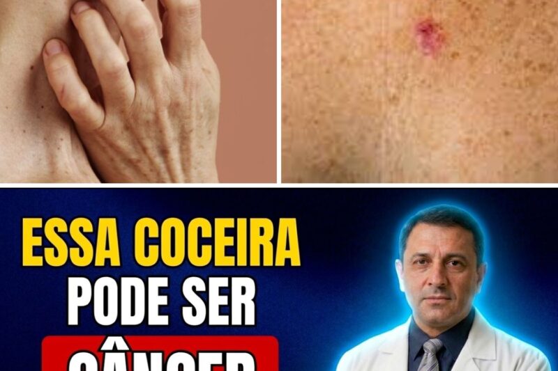 “Meu corpo estava gritando e eu ignorei”: coceira em 5 partes do corpo assusta médicos, acende alerta sobre câncer silencioso e deixa brasileiros em choque — veja os detalhes no primeiro comentário