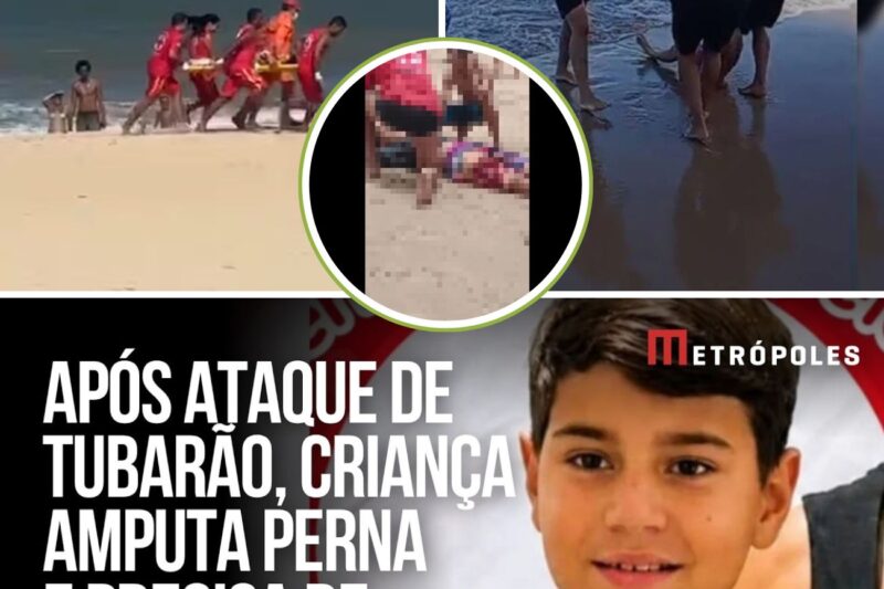 ““Foi horrível, ele quase morreu!” João Lucas, 11 anos, perde perna após ataque de tubarão em Pernambuco — Saiba como você pode ajudar”
